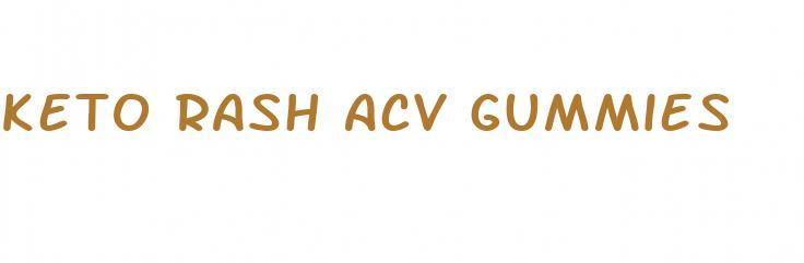 Keto Rash Acv Gummies – American Air Mail Society